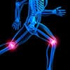 Photo of Bones & Joints